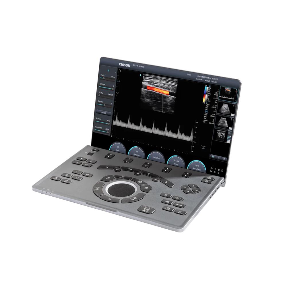 Έγχρωμος Υπέρηχος φορητός CHISON Sonoair 20